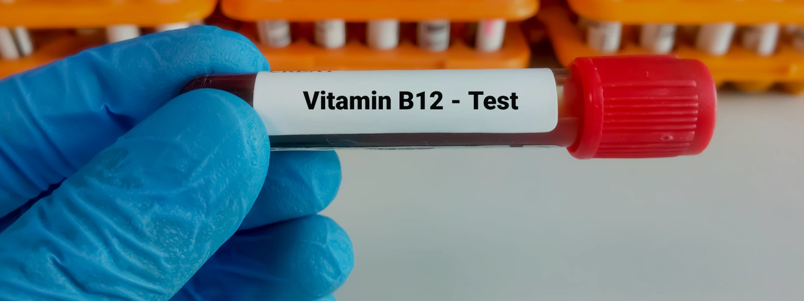 B12 Vitamini Değeri Kaç Olmalıdır?